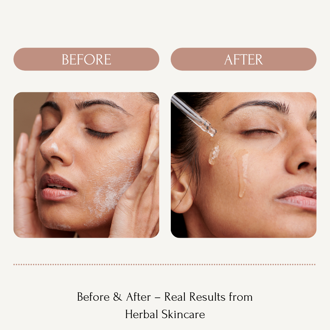 Before & After – Real Results from Herbal Skincare